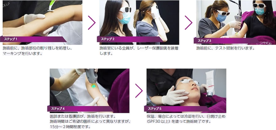 当日の施術の流れ